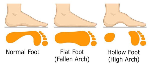 proper foot arch